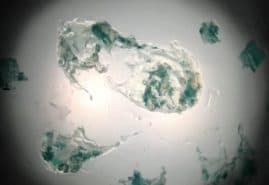 PROTOZOA, dir. 